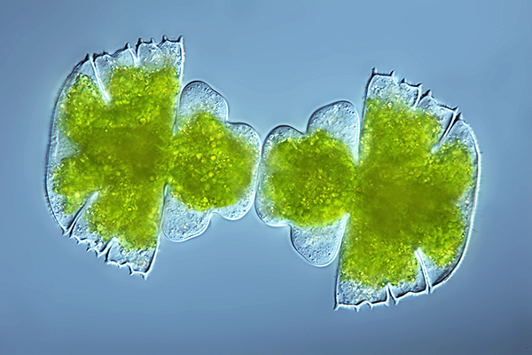 Phytoplankton on Wetpixel